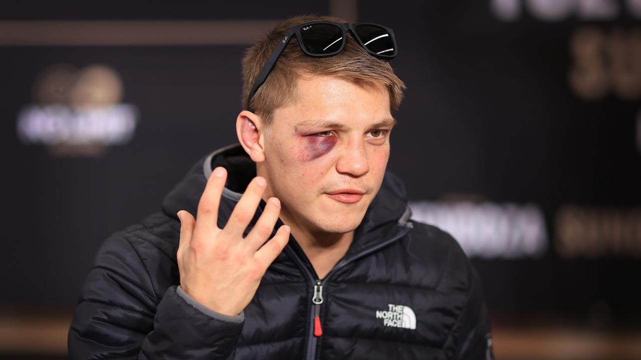 Nikita Tszyu shows a bruise he suffered in his win over Jack Brubaker on August 24, 2023 in Sydney, Australia. (Photo by Mark Evans/Getty Images)