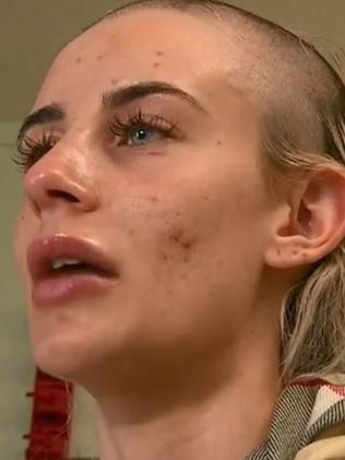 She said the worst part was having her head shaved. Picture: Channel 9