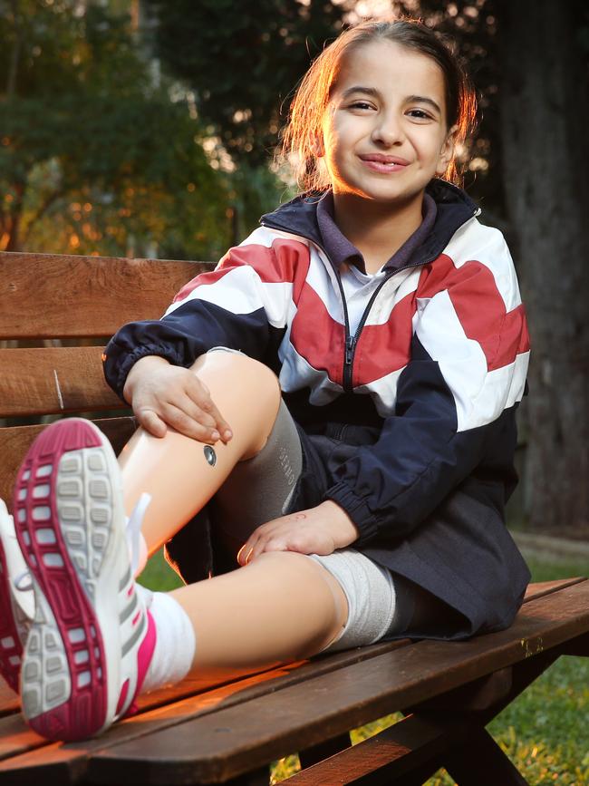 Bernadette Giribaldi has to wear prosthetic legs. Picture: Richard Dobson