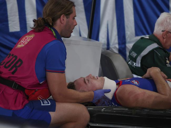 Luke Cleary suffered a concussion from the incident. Picture: Getty Images