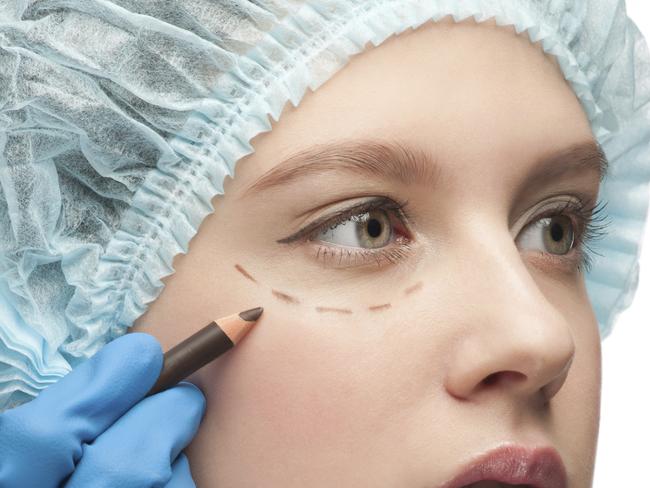 Female face before plastic surgery operationPERSONAL OZ Picture: Thinkstock