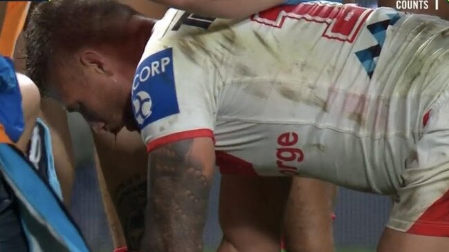 Sims bled from his lip following the hit. Image: Fox Sports