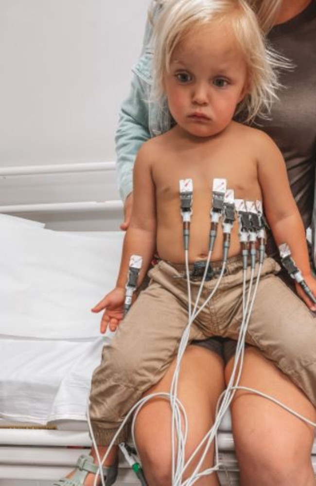 In 2019, Anakin Stimson was born with a complex form of congenital heart disease (CHD) where his heart’s right side aortic arch and left subclavian artery had not developed properly. Photo: contributed.