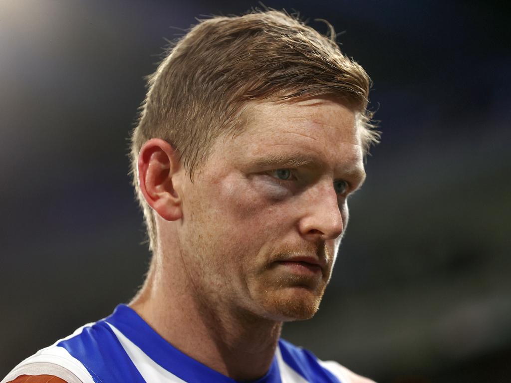 Ziebell will need surgery on his damaged eye. Picture: Michael Klein