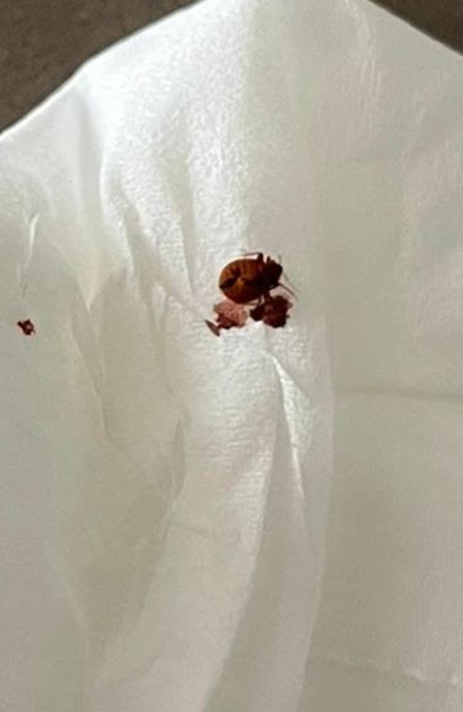 Benjamin and his girlfriend said they found this bed bug on the top of their pillows. Picture: Benjamin