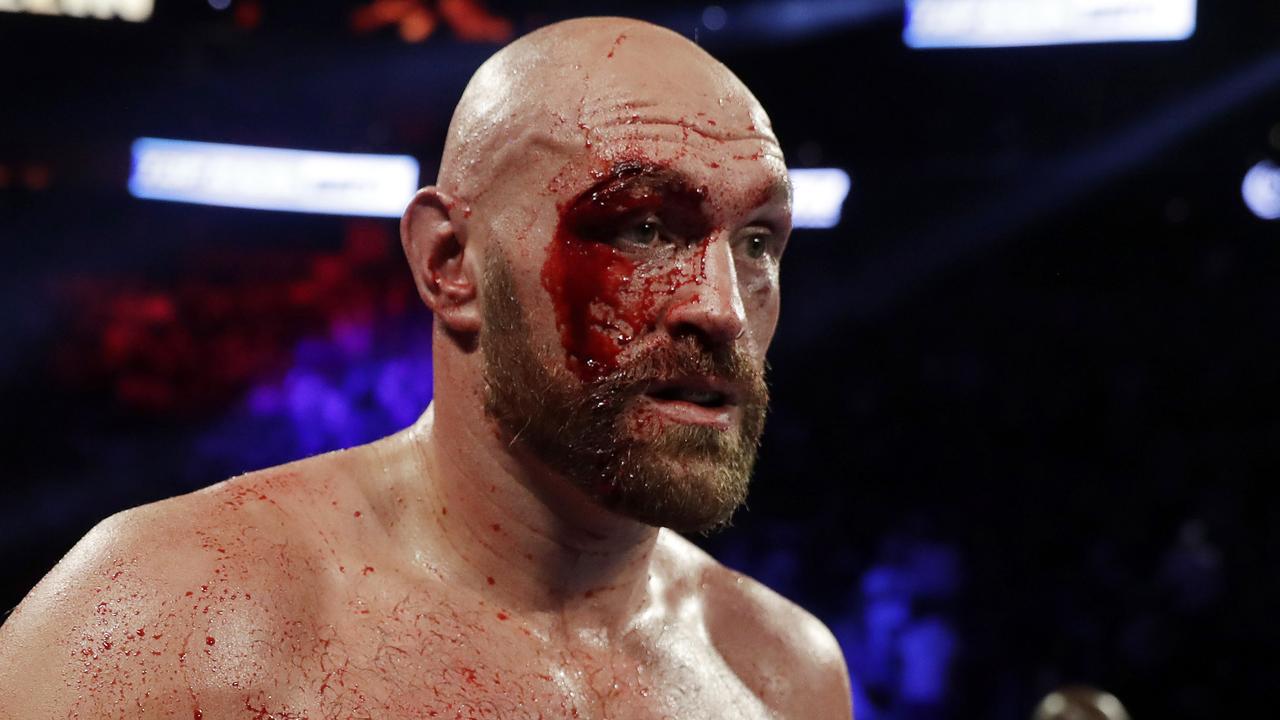 Tyson Fury survived a serious scare.