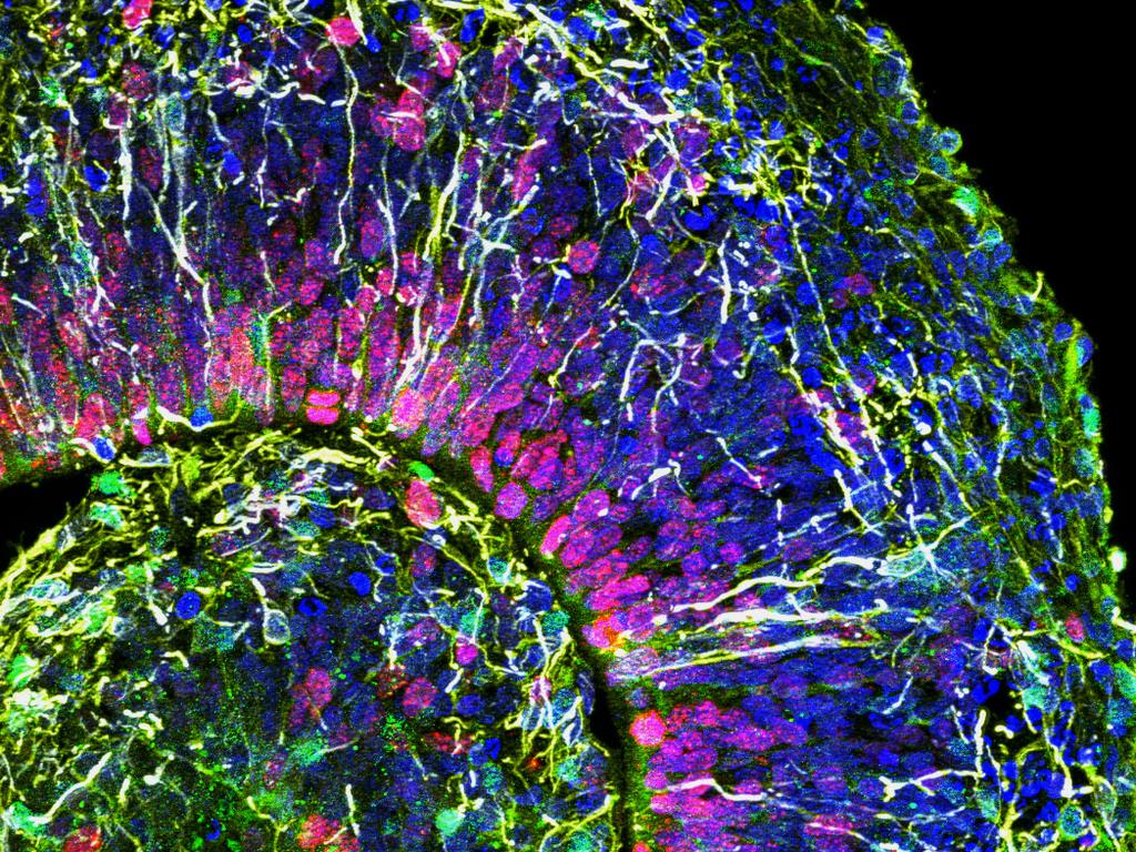 Emerging science. Живая ткань головного мозга in situ. Оптические измерения ткани головного мозга. Rhabdocalyptus dawsoni электрические импульсы. Lab grown Brains.