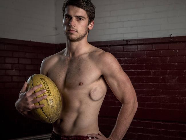 Stuart Goddard was fitted with a permanent defibrillator after his heart stopped on two separate occasions while he was playing football. Picture: Jake Nowakowski