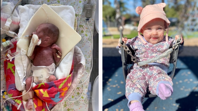 One of Australia’s most preterm babies takes a special step