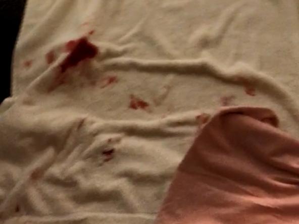 A video taken by the woman who was sexually assaulted by Jarryd Hayne showing blood on her bed after the assault. Picture: Supplied via NCA NewsWire,