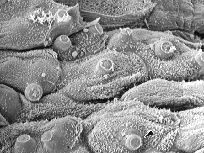 Electron microscope image of surface of frog skin covered by chytrid fungus, with fungal tubes poking through the skin (arrow) (Photograph by Lee Berger)