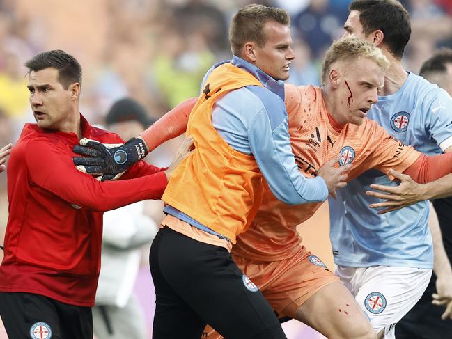 *** BESTPIX *** MELBOURNE, AUSTRALIA - DECEMBER 17: A bleeding Tom Glover of Melbourne City is escorted from the pitch by team mates after fans stormed the pitch during the round eight A-League Men's match between Melbourne City and Melbourne Victory at AAMI Park, on December 17, 2022, in Melbourne, Australia. (Photo by Darrian Traynor/Getty Images)