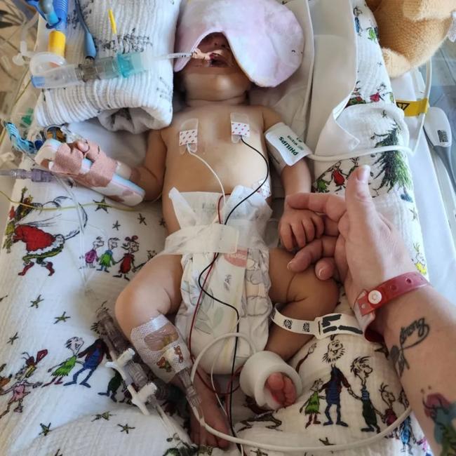 Baby Hazel Jackman, who was born in Hobart, is in Melbourne with her parents Bridget Flanagan and Damien Jackman awaiting further life-saving surgery. Picture: Supplied by the family