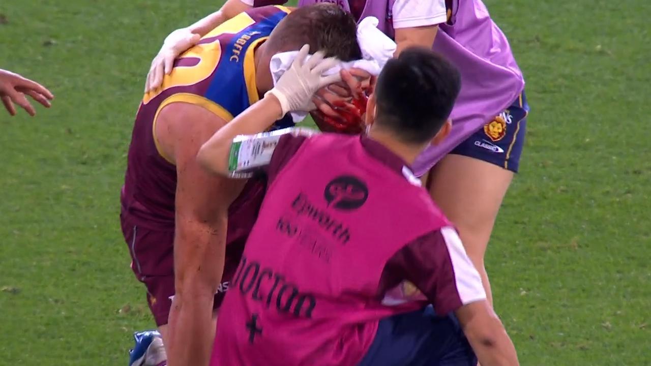 Jack Payne was subbed from the game after a nasty head knock.
