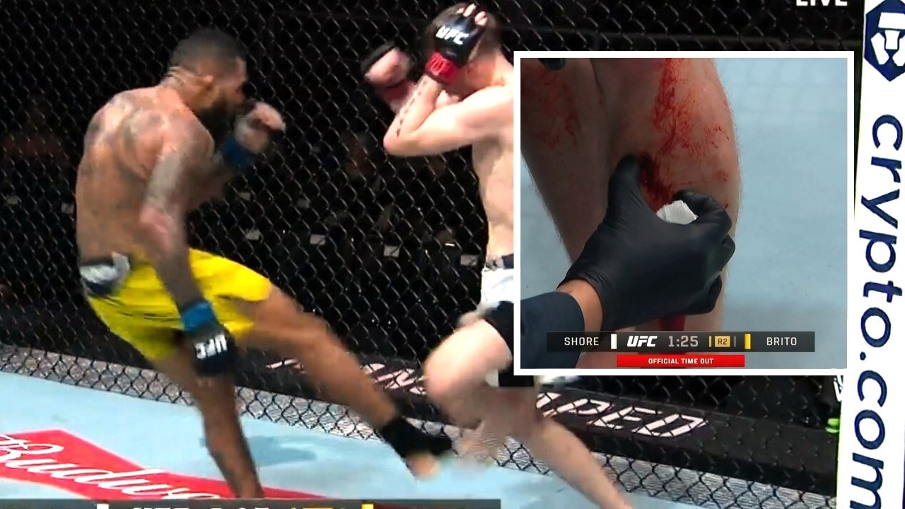 Jack Shore's leg was absolutely devastated. Photo: Main Event.