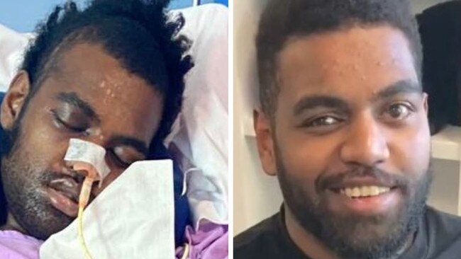 Police have charged a man with multiple offences over a shocking pre-Christmas crash which left 20-year-old Tin Can Bay man Nemani Ranuve (pictured) in a coma with life threatening injuries.