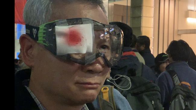 Kenny Chow is angry after a girl was allegedly shot in Hong Kong at a protest. Picture: Campbell Gellie