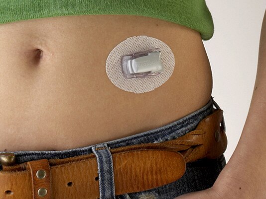 Fake pancreas gives hope to sickest Aussie diabetics