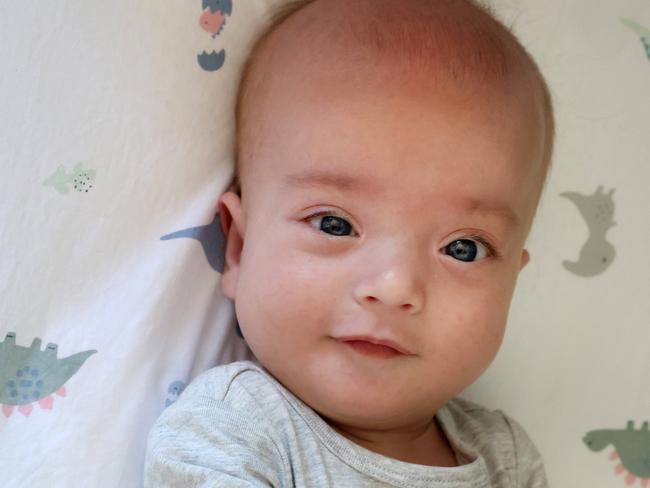 Baby Noah has been given one or two years to live. Picture: Liam Kidston.