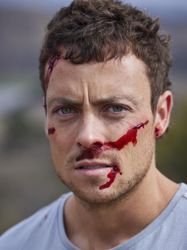 Actor Patrick O'Connor as a bloodied Dean Thompson on Home And Away. Picture: Supplied