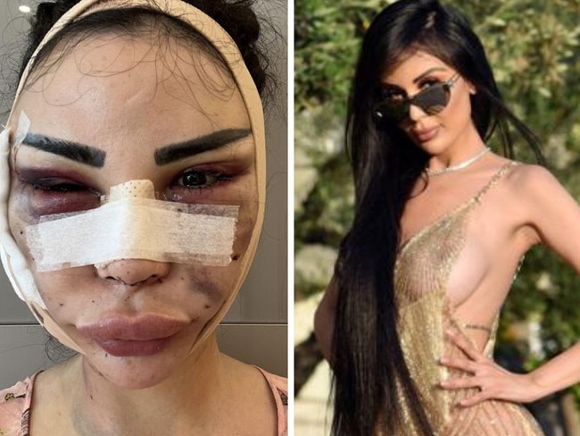 ‘I spent $800k to look like Kim K’