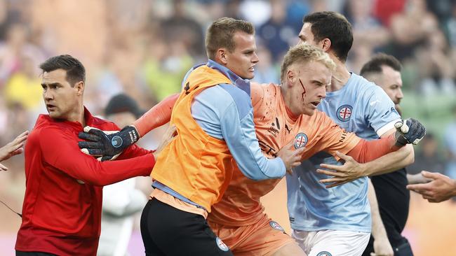 A bleeding Tom Glover of Melbourne City is escorted from the pitch by team mates after fans stormed the pitch at AAMI Park. Picture: Darrian Traynor/Getty Images