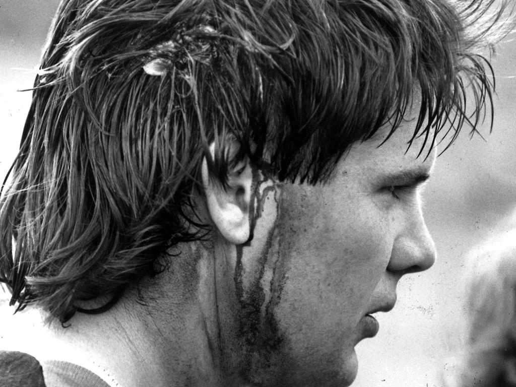 Frawley, bleeding from a cut above his ear, was no stranger to head injuries.