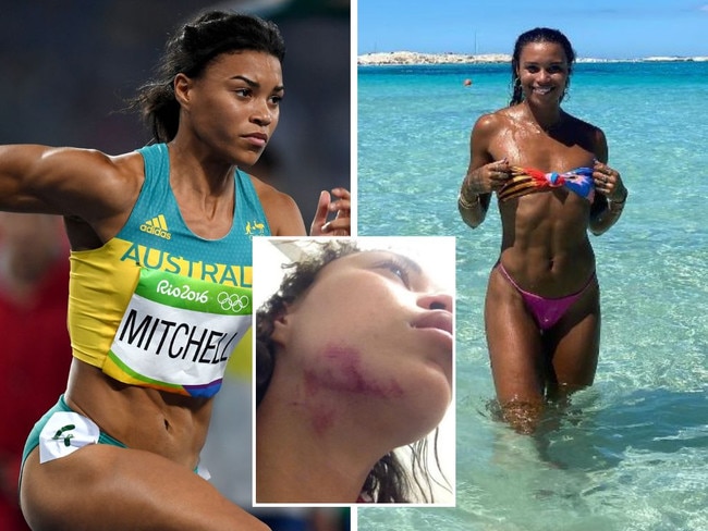 ‘Nearly lost my life’: Olympians’ shock reveal