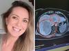 Scan shows ‘deadly’ cancer on the rise in Aus