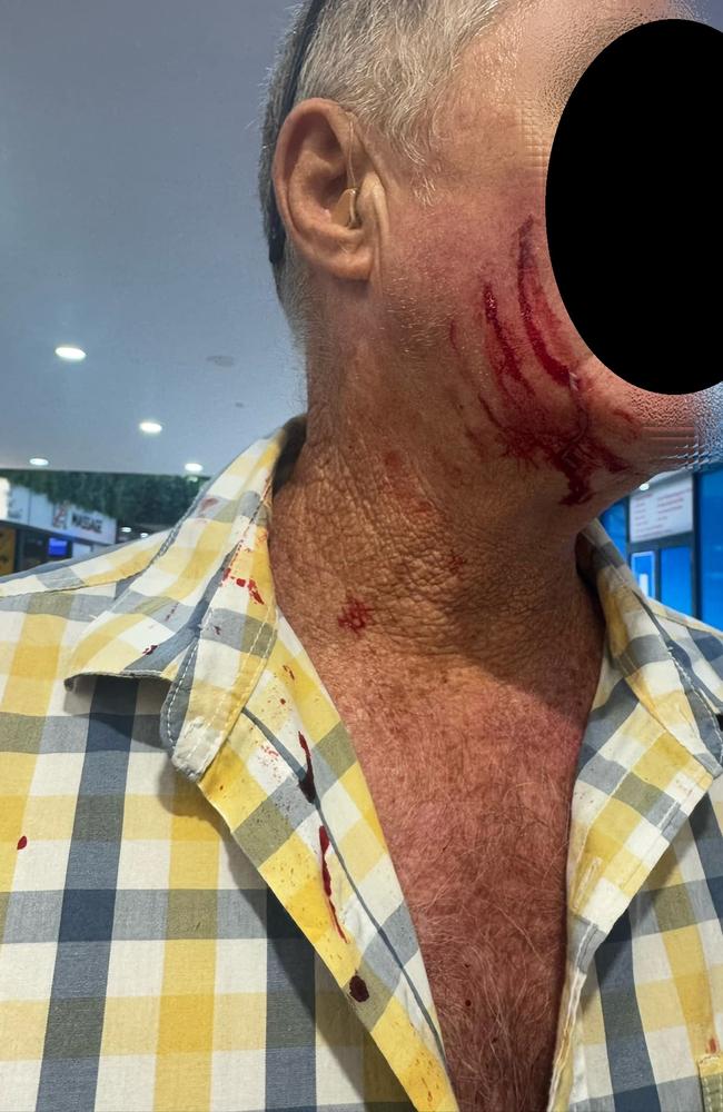 Shocking images have surfaced from Nerang where a young male allegedly attacked an elderly man at knifepoint. Picture: Facebook