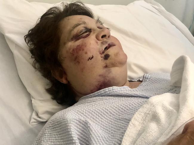 An elderly woman was left bloodied and bruised after a savage attack outside a church in South Yarra, Penelope Katsavos was left bloodied and bruised after the horrific attack.