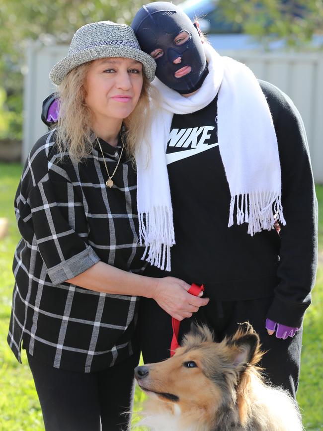 Stephanie with her devoted mum Marie and dog Arlo shortly after being released from hospital, and returning to her Craigieburn home. Picture: Alex Coppel