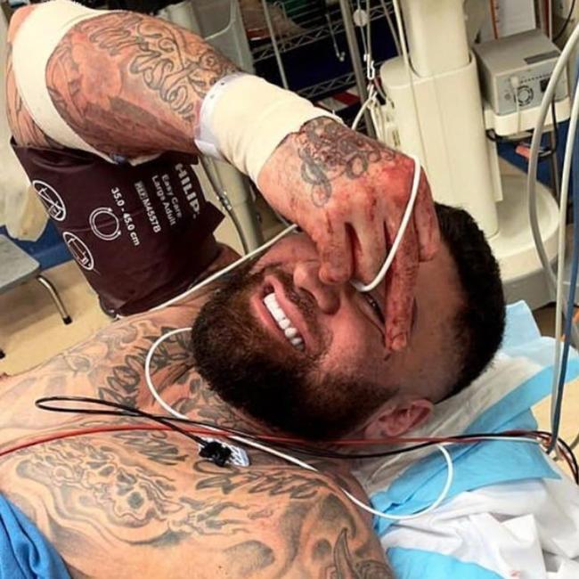 John Lavulo drove himself to hospital following the alleged shooting. Picture: Instagram