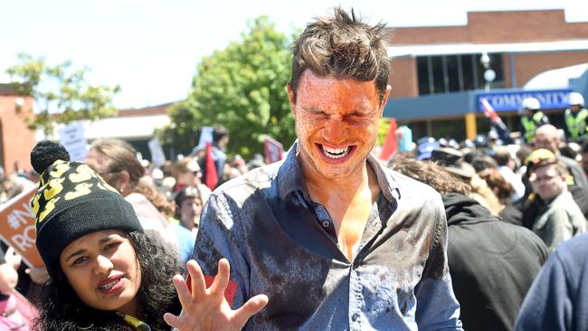 A anti-racism protester is treated for pepper spray during the rally.. Picture: Mike Keating.