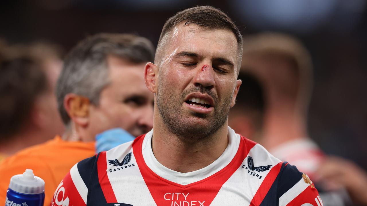 James Tedesco was ruled out after the high shot from Bailey Simonsson. Picture: Getty Images