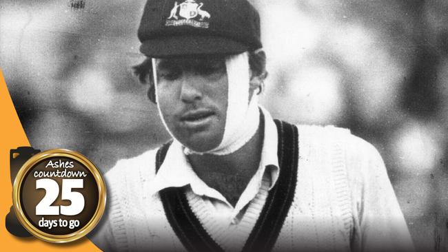 Rick McCosker bats with a broken jaw in the Centenary Test.