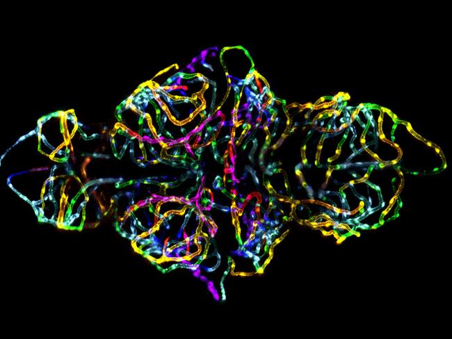 MUST CREDIT NIKON PHOTOMICROGRAPHY COMPETITION 1ST PLACE2012 PHOTOMICROGRAPHY COMPETITIONDr. Jennifer L. Peters & Dr. Michael R. TaylorSt. Jude Children's Research HospitalMemphis, Tennessee, USASubject Matter:The blood-brain barrier in a live zebrafish embryo (20x)Technique:ConfocalDr. Jennifer Peters' and Dr. Michael Taylor's winning image of the blood-brain barrier in a live zebrafish embryo perfectly demonstrates the intersection of art and science that drives the Nikon Small World Competition.The blood-brain barrier plays a critical role in neurological function and disease. Drs. Peters and Taylor, developed a transgenic zebrafish to visualize the development of this structure in a live specimen. By doing so, this model proves that not only can we image the blood-brain barrier, but we can also genetically and chemically dissect the signaling pathways that modulate the blood-brain barrier function and development.To achieve this image, Peters and Taylor used a maximum intensity projection of a series of images acquired in the z plane. The images were first pseudo-colored with a rainbow palette based on depth so that the coloring scheme would be both visually appealing and provide spatial information. In doing so, Peters and Taylor captured an image that Peters says�not only captures the beauty of nature, but is also topical and biomedically relevant.�Both Peters and Taylor have more than ten years of imaging experience. Peters is an imaging scientist in the St. Jude Children's Research Hospital's Light Microscopy Core Facility and Taylor is an Assistant Member in the Department of Chemical Biology and Therapeutics at St. Jude Children's Research.