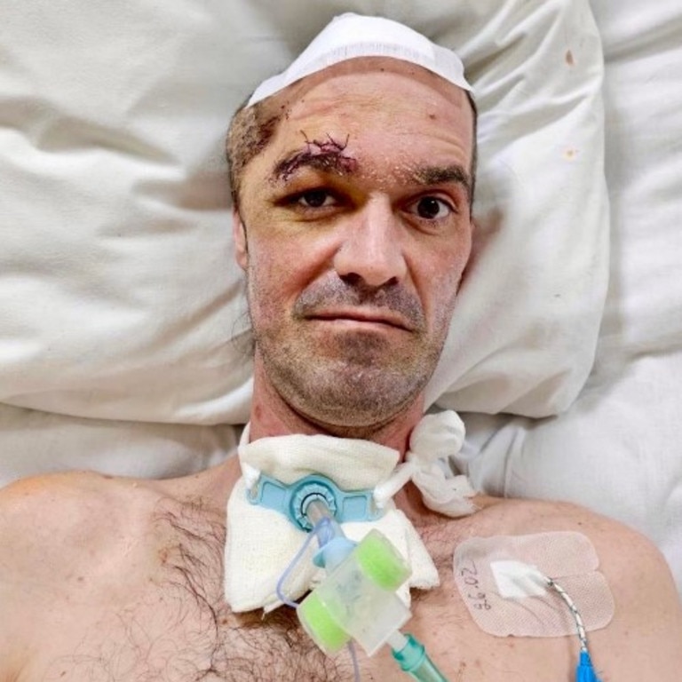 The Gold Coast community is being called upon to rally around beloved local entertainer Brady Mayer, who is facing a long and uncertain recovery after a devastating brain injury earlier this year.