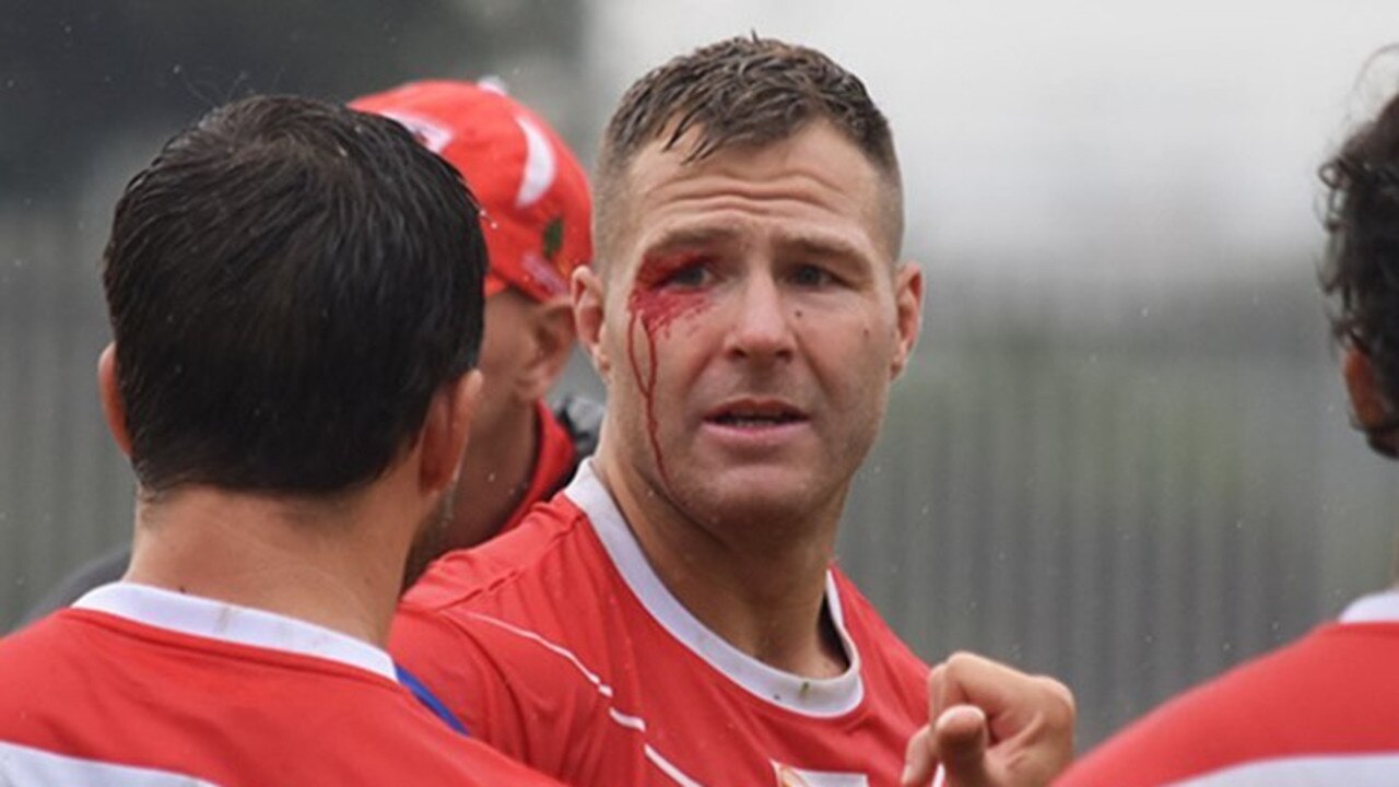 Trent Merrin isn’t the only Dragons player to need stitches from a training clash this year.