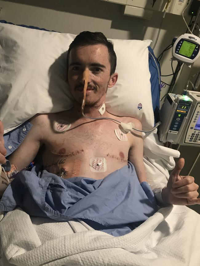 Blue Heelers footballer Matt Wills post his double lung transplant. Picture: Supplied