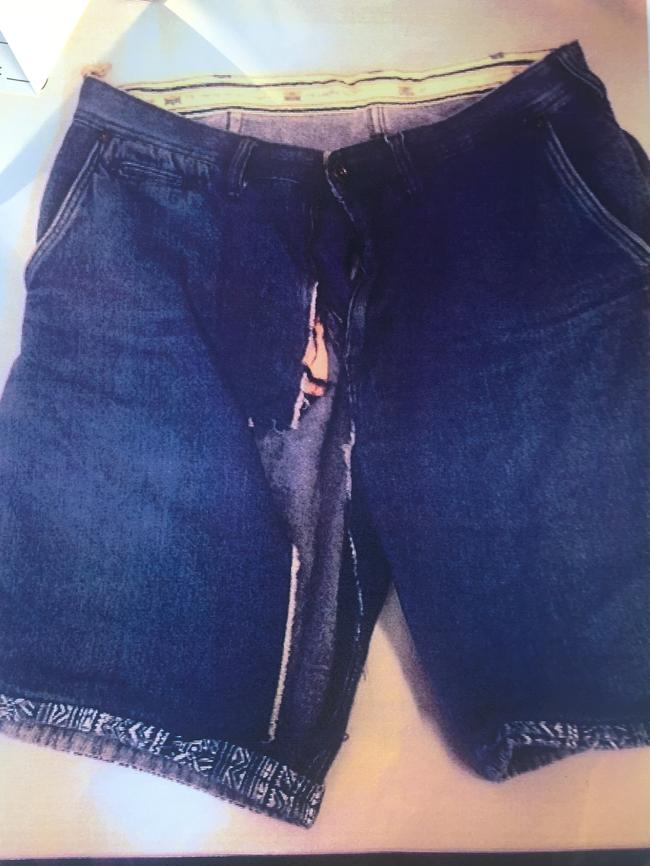 The victim’s ripped shorts.