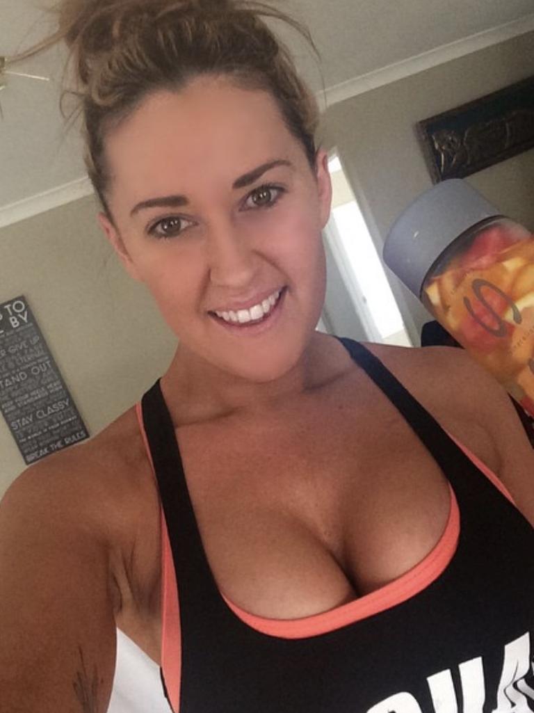 Nicola Robinson reveals the reason behind having her breast implants removed