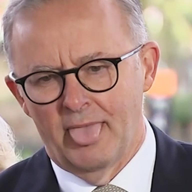 Anthony Albanese 7492