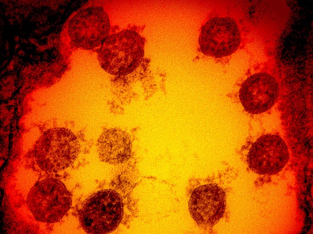 SARS-CoV-2 virus particles, isolated from a patient. Picture: NIAID via Getty Images.