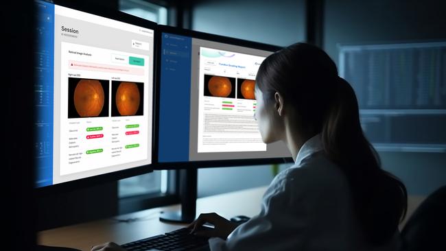 A clinician using AI technology developed by Melbourne eye disease company Eyetelligence.