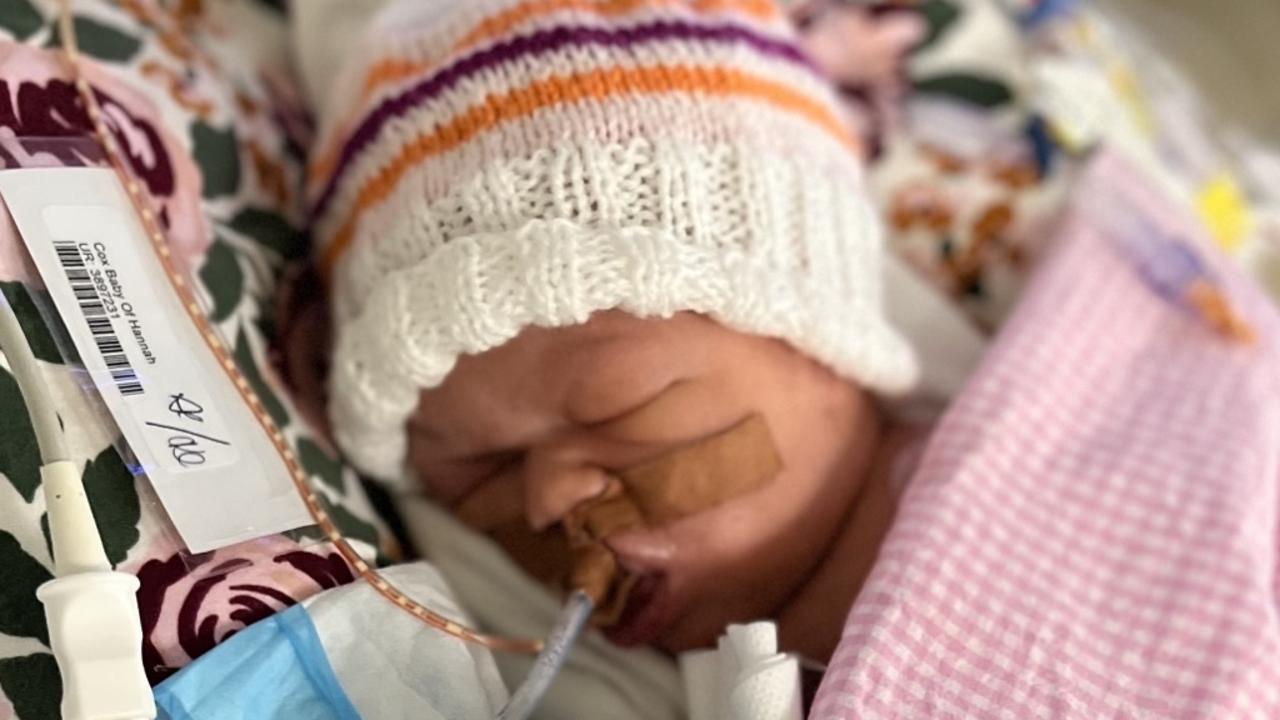 ‘Our miracle’: Baby defies 1 in 4000 odds