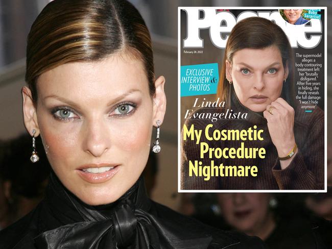 ‘Disfigured’ supermodel’s shock injury photos