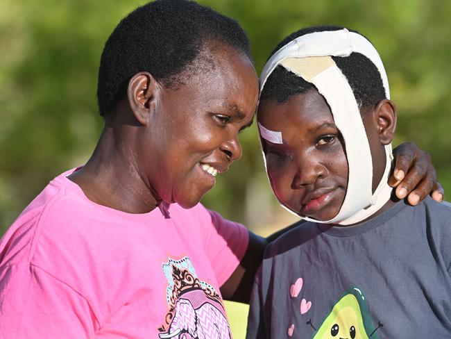 28/1/25. Elinah Chibuye, 16, from a remote village in Zambia has had a big facial tumour removed at WCH thanks to the Children First Foundation and the Ronald McDonald House. Mum Rabecca Kalunga with Elinah.Picture: Keryn Stevens