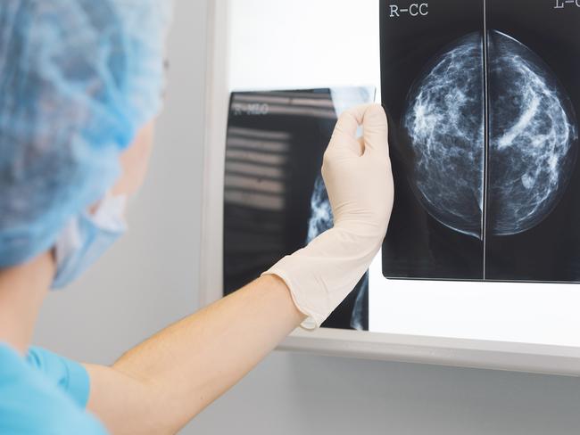 There’s hope a new vaccine will stop cancer returning in breast cancer patients.