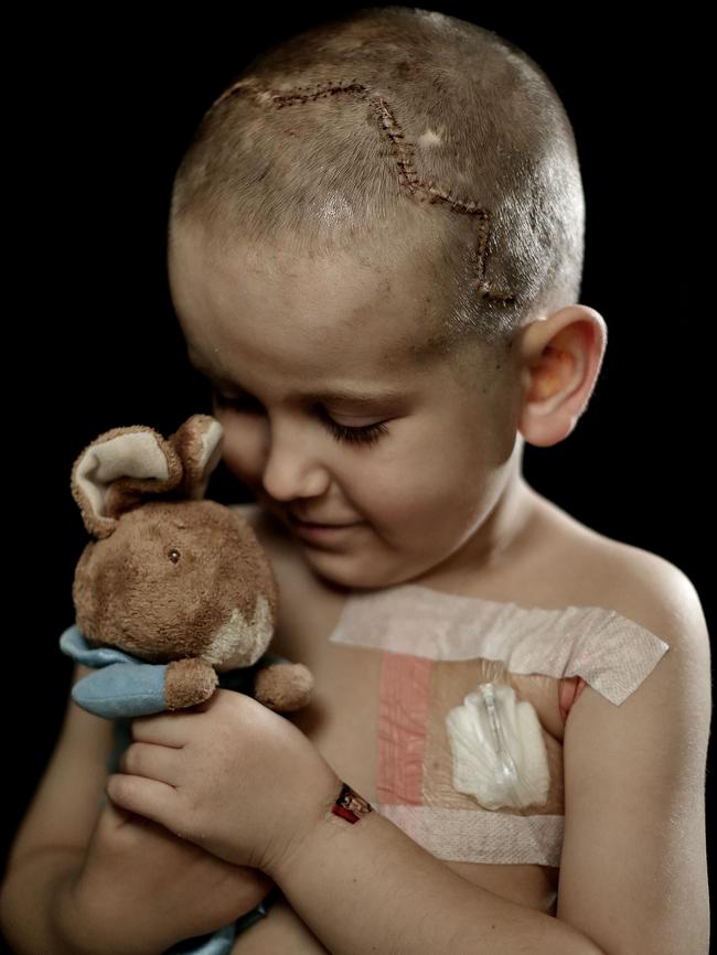 Josh Carter checks in with cuddly toy Babbit after his operation in 2012.